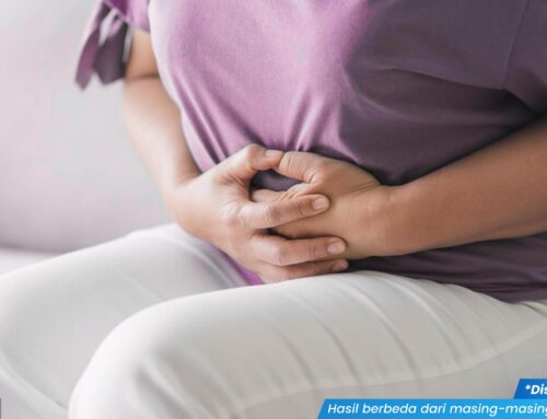 3 Cara Mengatasi Penyakit Jengger Ayam dengan Penanganan Medis, Cek Saran Dokter Yuk!