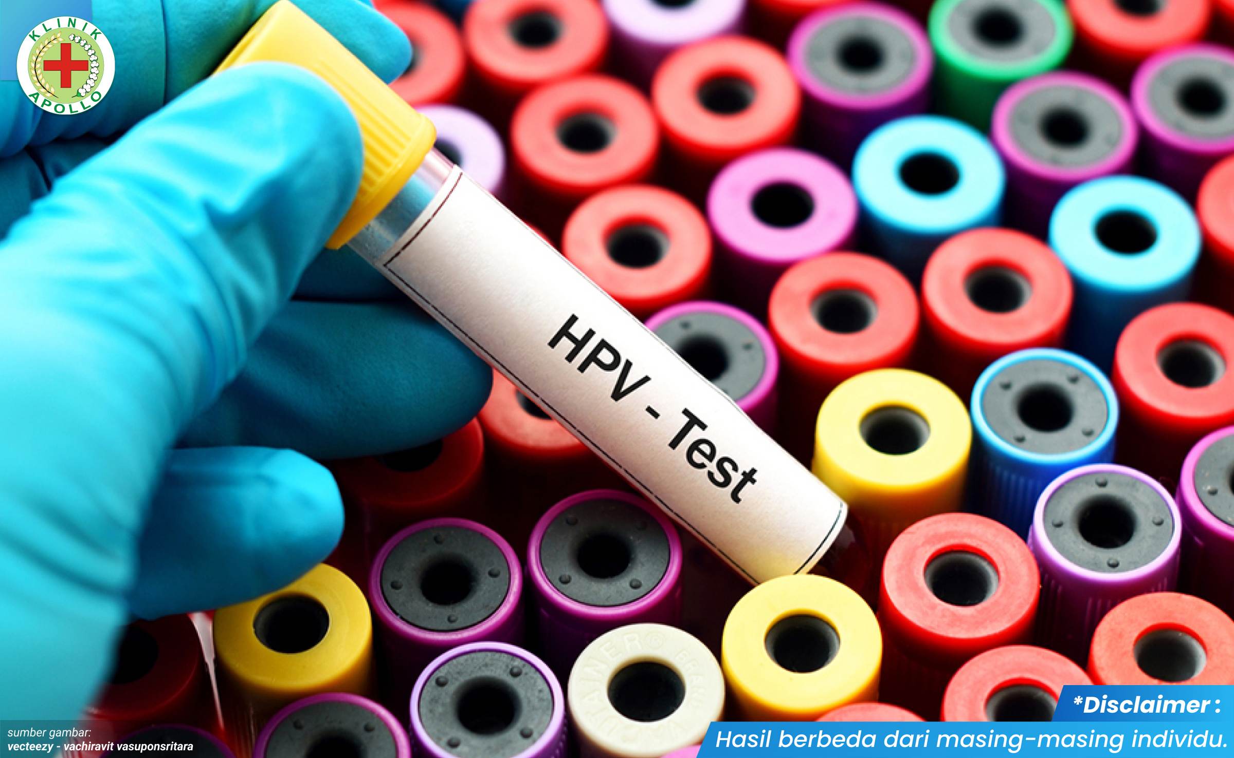 penyakit jengger ayam 2_6_11zon