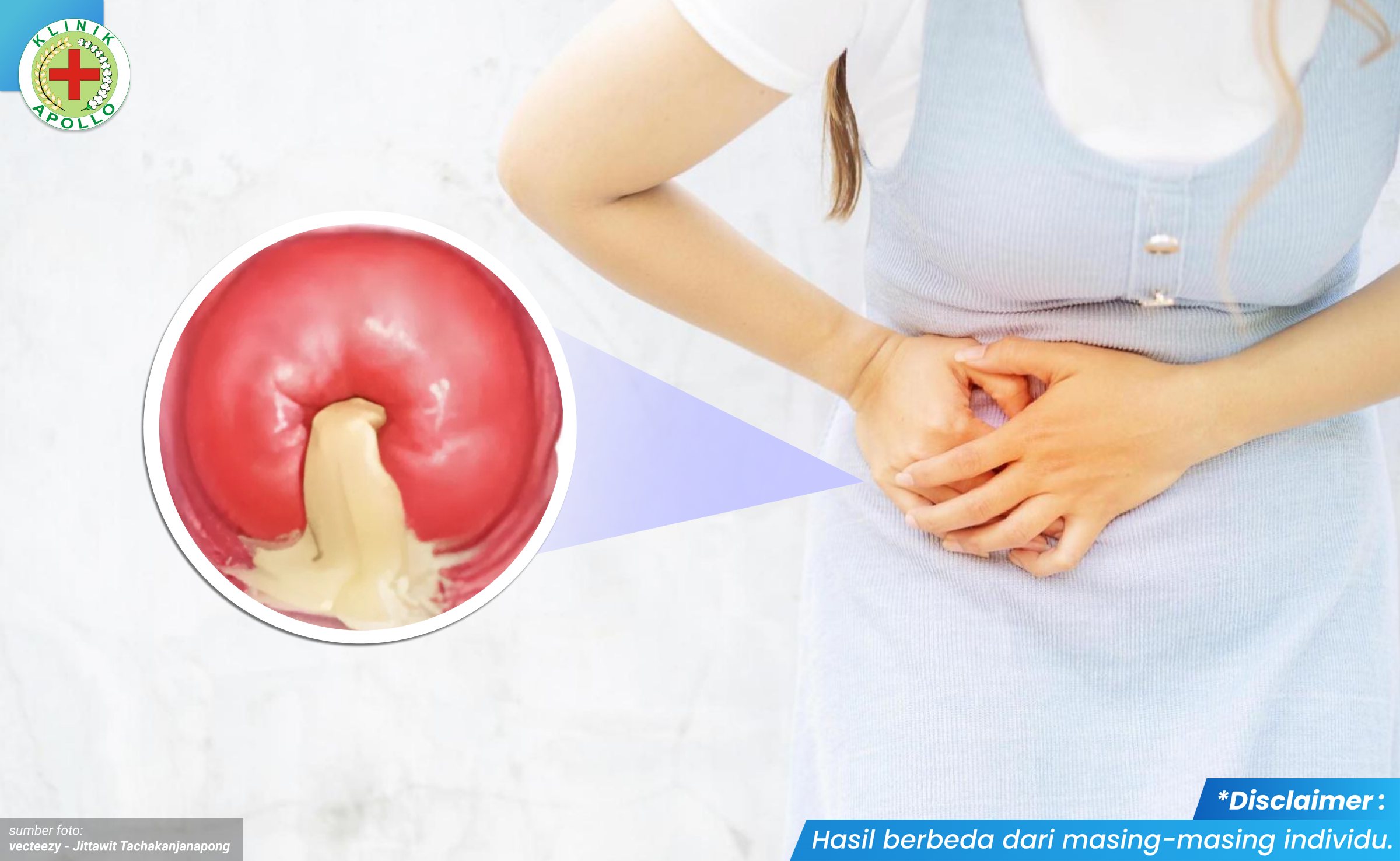 Kelamin Nyeri dan Bernanah 1_3_11zon