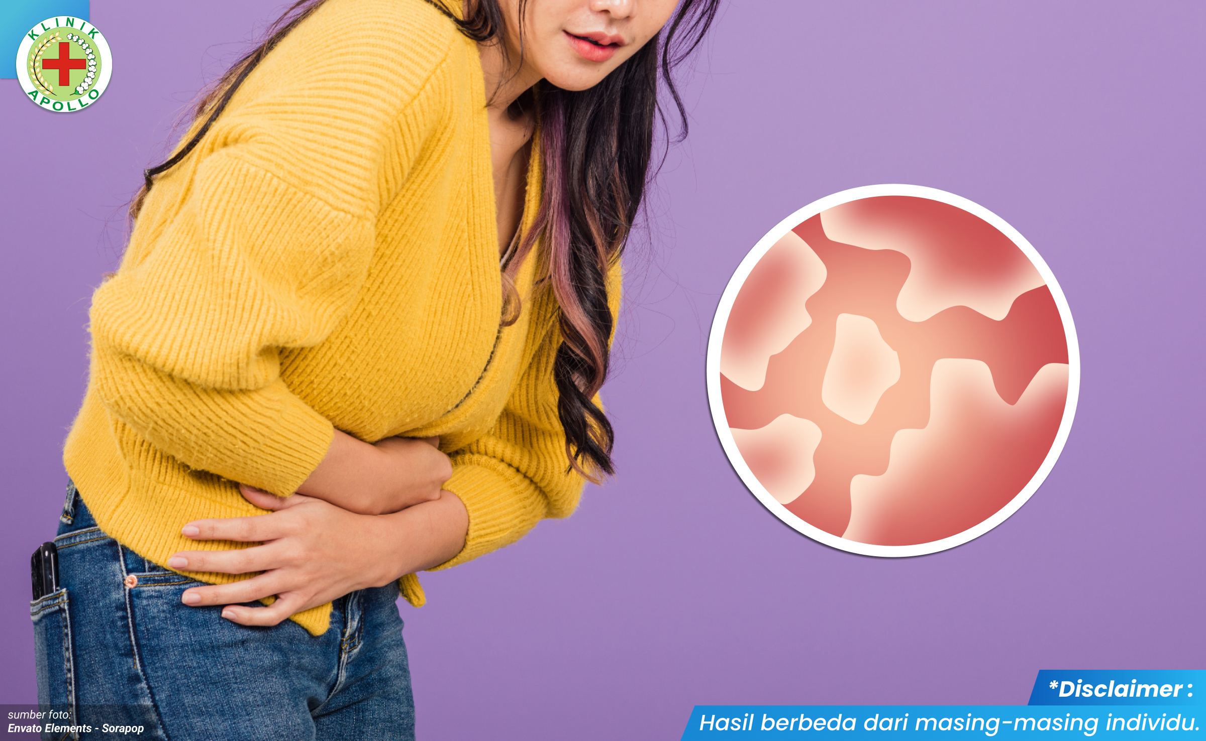 bercak putih gatal di vagina 1_2_11zon