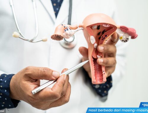 Luka Lecet di Miss V Akibat Infeksi, Kenali Gejala dan Pengobatannya!