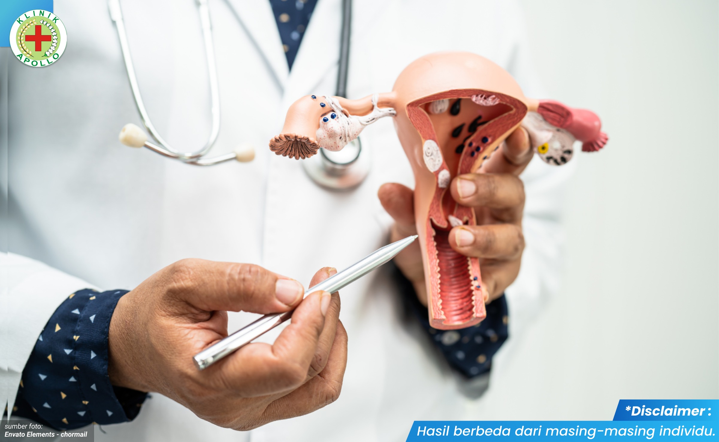 luka lecet di miss v 1_4_11zon