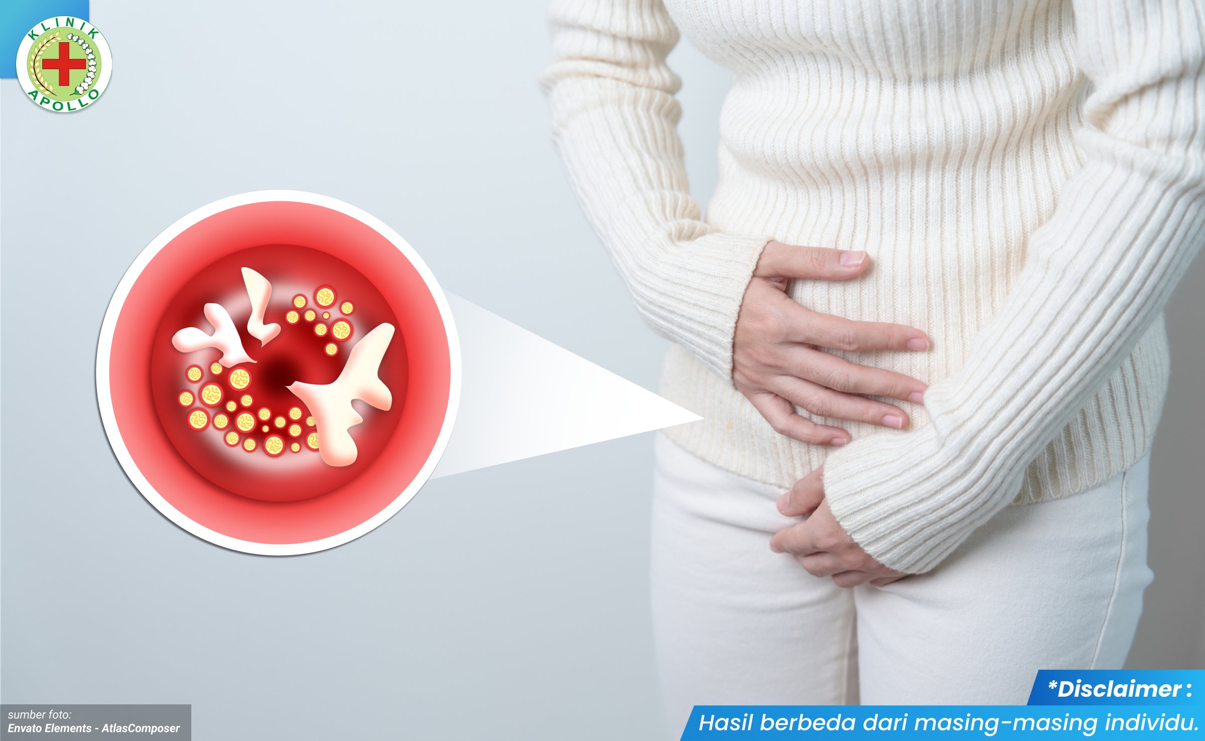 penyebab infeksi mulut rahim 1_5_11zon