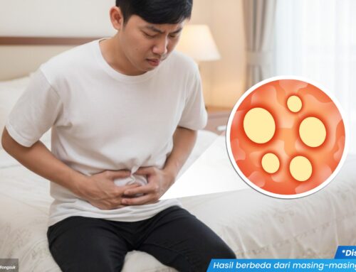 Ciri Sifilis Stadium Awal yang Kerap Disalahartikan sebagai Luka Biasa, Waspada!