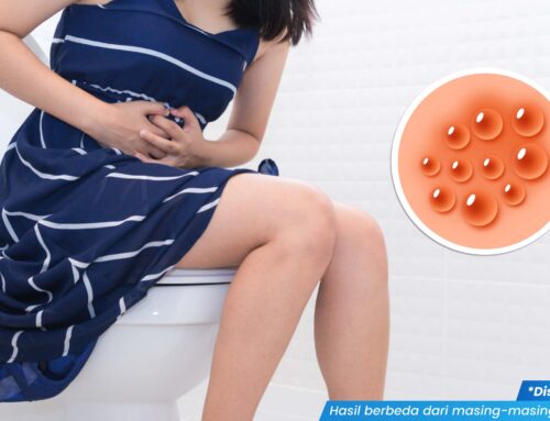 Muncul Benjolan Besar di Miss V Bagian Luar? Waspada Kista Bartholin!