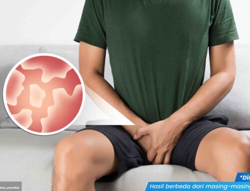 Kenapa Jamur Candida pada Kelamin Sering Muncul Saat Daya Tahan Tubuh Turun? Cek Penjelasan Dokter!