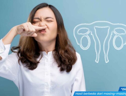 Bukan Hormon! Ini Dia Infeksi yang Sebabkan Keputihan Bau dan Berlebih