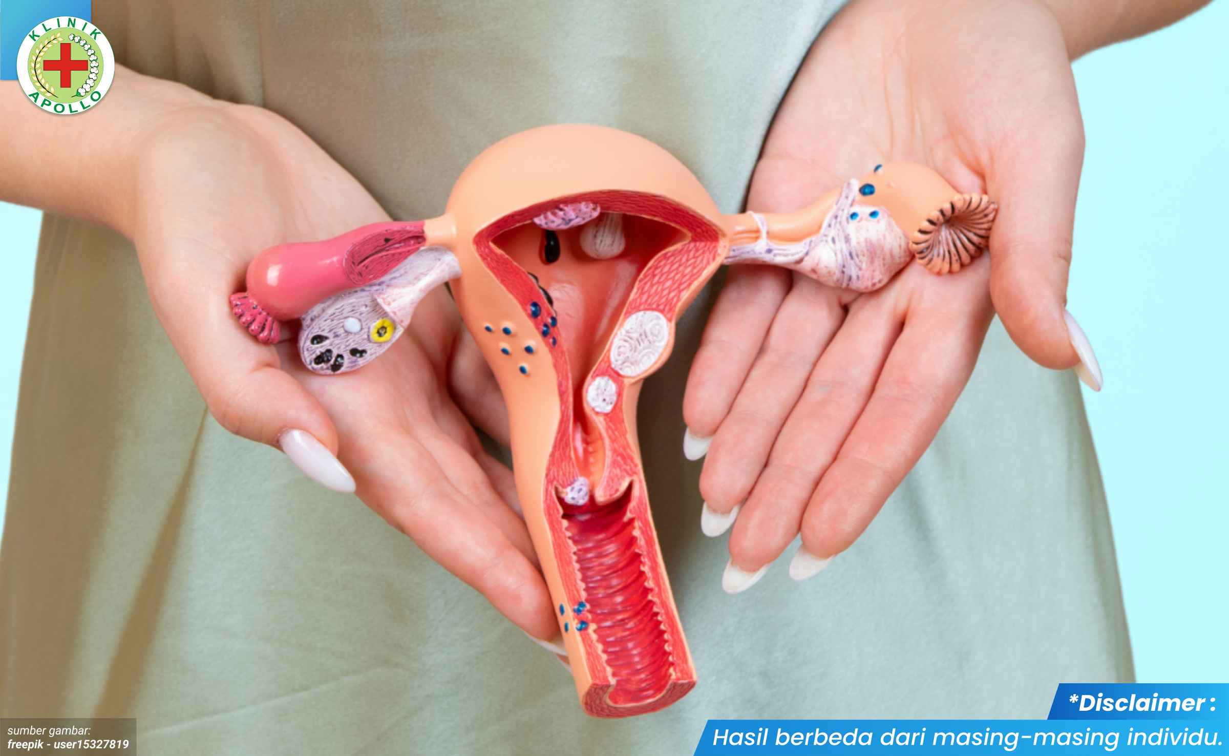 pengobatan vaginitis 2_1_11zon