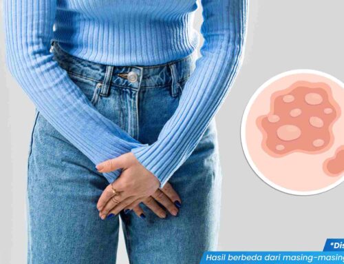 Berapa Lama Waktu yang Dibutuhkan untuk Menyembuhkan Herpes di Miss V? Cek Penjelasannya Yuk!