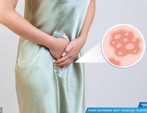 Berapa Lama Waktu yang Dibutuhkan untuk Menyembuhkan Herpes di Miss V? Cek Penjelasannya Yuk!