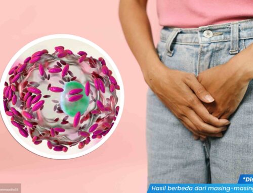 Bacterial Vaginosis: Gejala, Penyebab dan Cara Mengobatinya