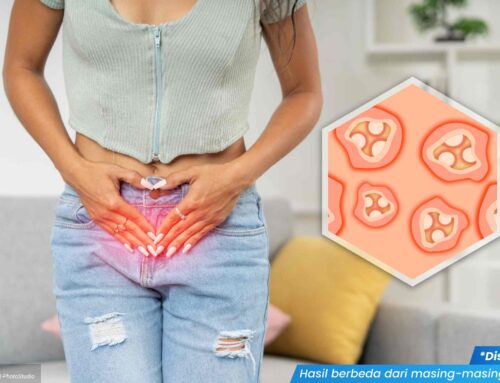 Cara Mengatasi Vagina Gatal dan Kapan Harus ke Dokter