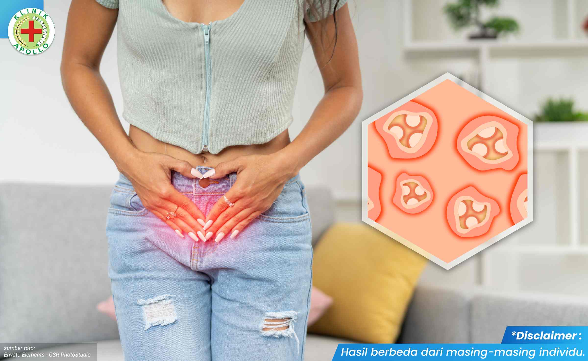 Cara Mengatasi Vagina Gatal 1_1_11zon