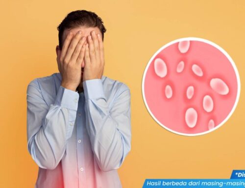 Penyebab Penis Lecet: Kenali 7 Pemicu dan Cara Mengatasinya