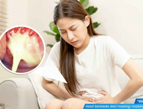 Penyebab Infeksi Jamur Tak Kunjung Sembuh & Solusinya