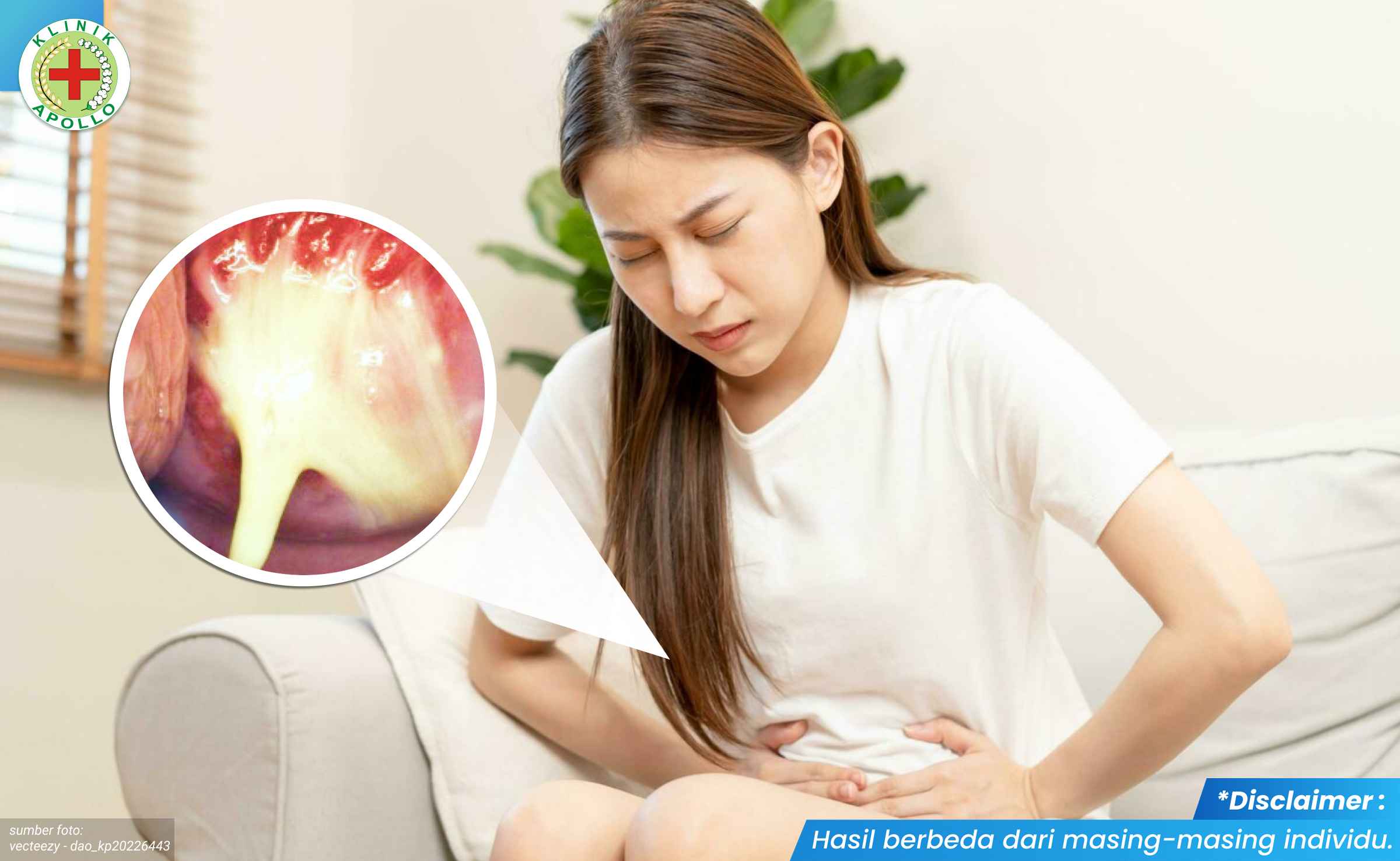 Infeksi jamur Tak Kunjung Sembuh 1_1_11zon