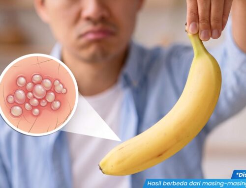 Kepala Penis Gatal? Kenali Penyebab dan Cara Mengatasinya