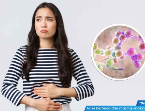 Infeksi Jamur Kandidiasis: Gejala, Penyebab, dan Pengobatan