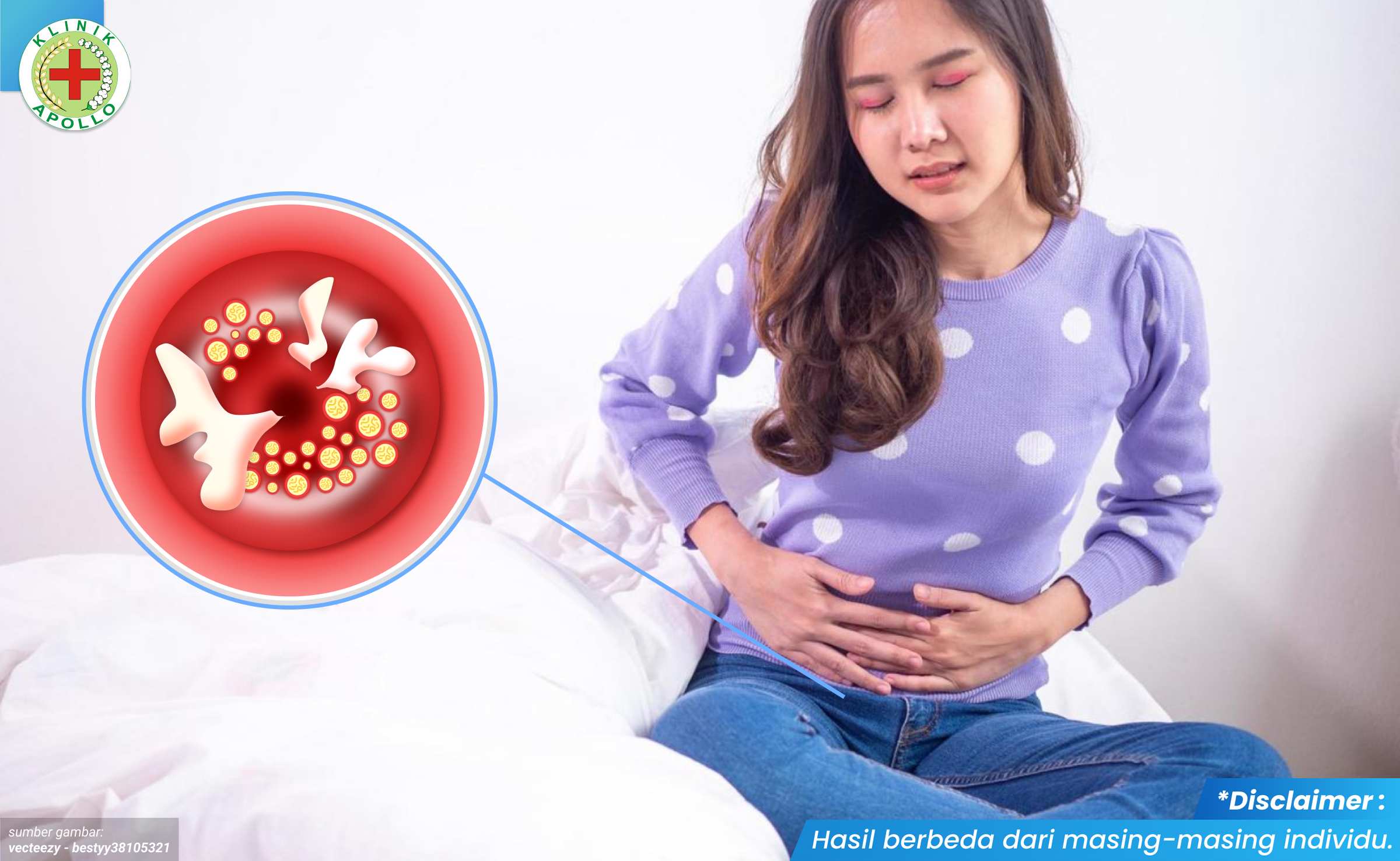 kenapa vagina terasa gatal 2_6_11zon