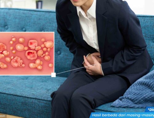 Obat Vagina Gatal: Pilihan Penanganan dan Kapan Perlu ke Dokter