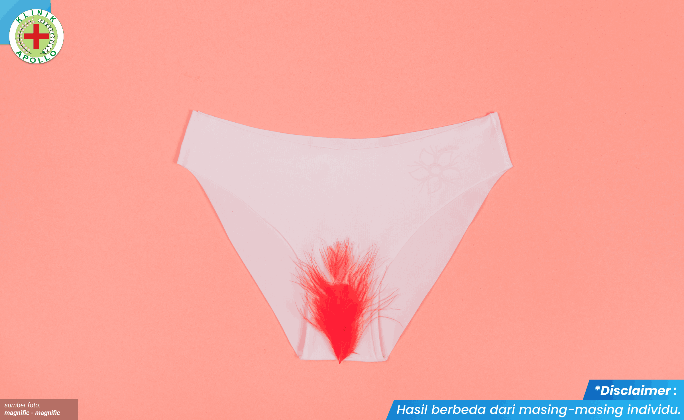 vagina gatal dan keputihan 1-1_10_11zon