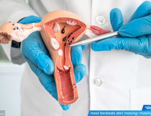 Vagina Gatal dan Panas: Penyebab serta Cara Mengatasinya