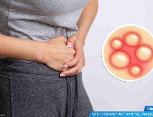 Vagina Gatal dan Bentol: Penyebab serta Cara Mengatasinya