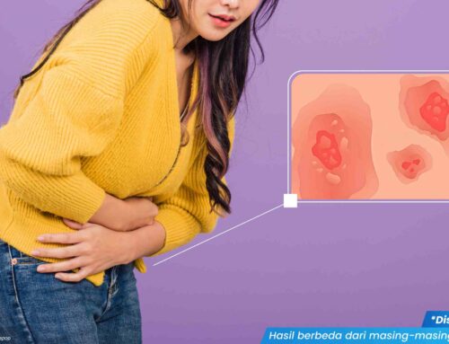 Vagina Gatal Lecet, Apa Penyebab dan Cara Mengobatinya?